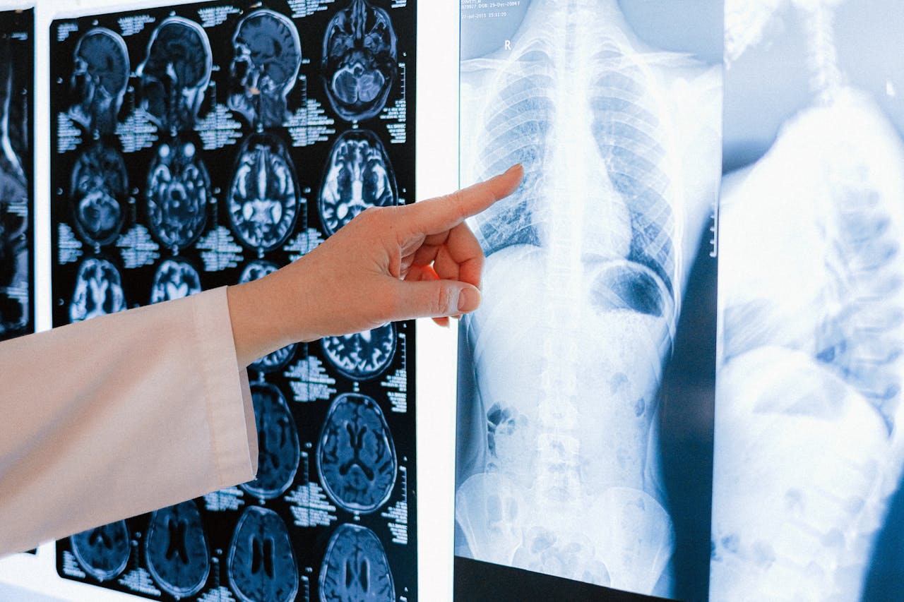 A doctor pointing at a chest X-ray among MRI scans in a medical clinic.